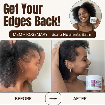 Qhemet Biologics MSM & Rosemary Scalp Nutrients Balm