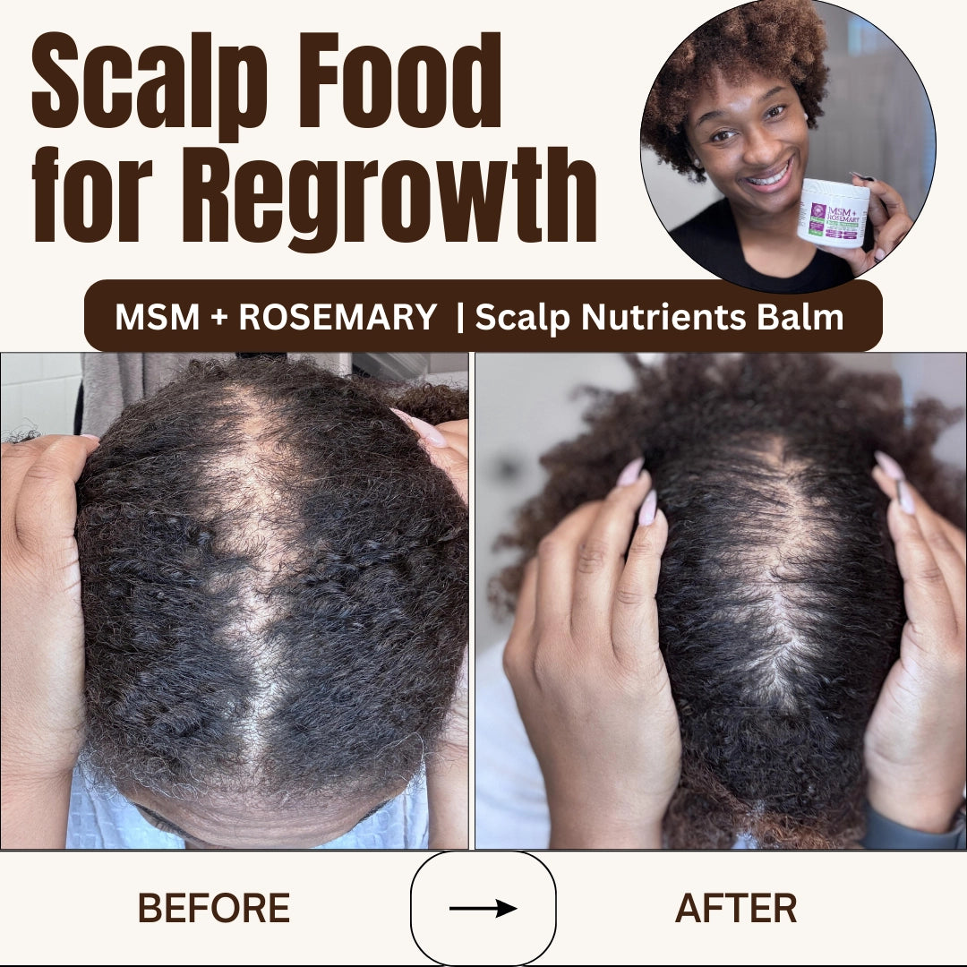 Qhemet Biologics MSM & Rosemary Scalp Nutrients Balm