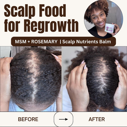 Qhemet Biologics MSM & Rosemary Scalp Nutrients Balm