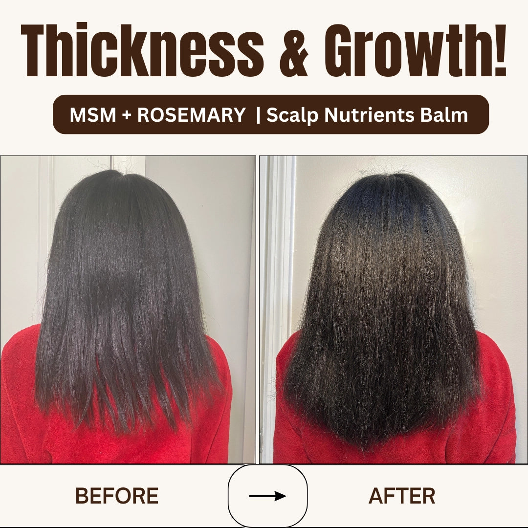 Qhemet Biologics MSM & Rosemary Scalp Nutrients Balm